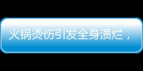 火鍋燙傷引發(fā)全身潰爛，三歲男童遭遇驚魂事件
