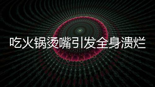 吃火鍋燙嘴引發(fā)全身潰爛，警醒！火鍋美食背后的健康隱患