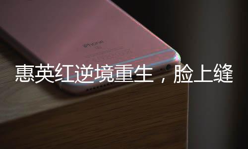 惠英紅逆境重生，臉上縫了89針的堅(jiān)韌故事
