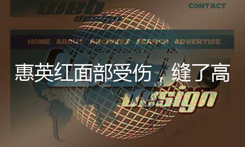 惠英紅面部受傷，縫了高達(dá)89針——深度解析其事故與現(xiàn)狀