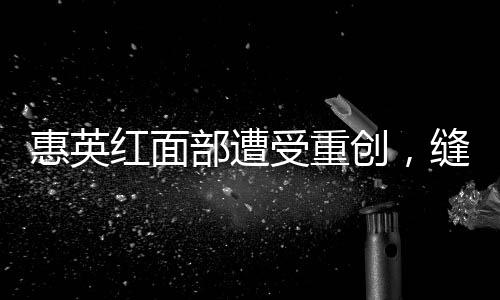 惠英紅面部遭受重創(chuàng)，縫針達(dá)89次——演藝界的堅(jiān)韌之星