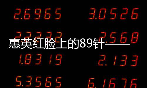 惠英紅臉上的89針——她的故事讓人感動