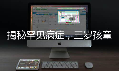 揭秘罕見病癥，三歲孩童全身離奇起皮脫衣事件引發(fā)關(guān)注