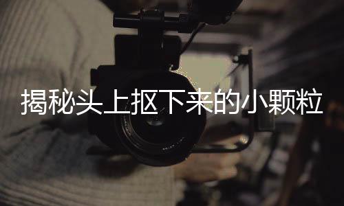揭秘頭上摳下來的小顆粒，真相究竟是何物？