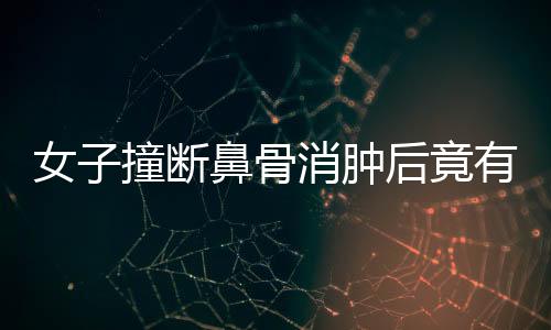 女子撞斷鼻骨消腫后竟有高鼻梁，奇妙經(jīng)歷揭示醫(yī)學(xué)魅力
