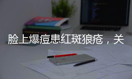 臉上爆痘患紅斑狼瘡，關(guān)注病癥與應(yīng)對(duì)之道