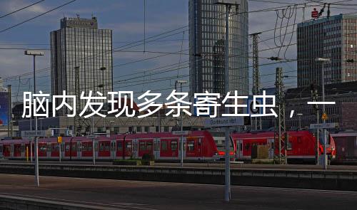 腦內(nèi)發(fā)現(xiàn)多條寄生蟲，一種健康警示